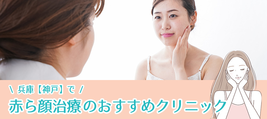 兵庫【神戸】で赤ら顔治療ができるおすすめクリニック8選