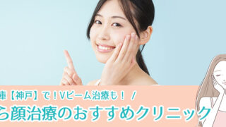 安い！兵庫【神戸】で赤ら顔治療ができるおすすめクリニック8選！Vビーム治療