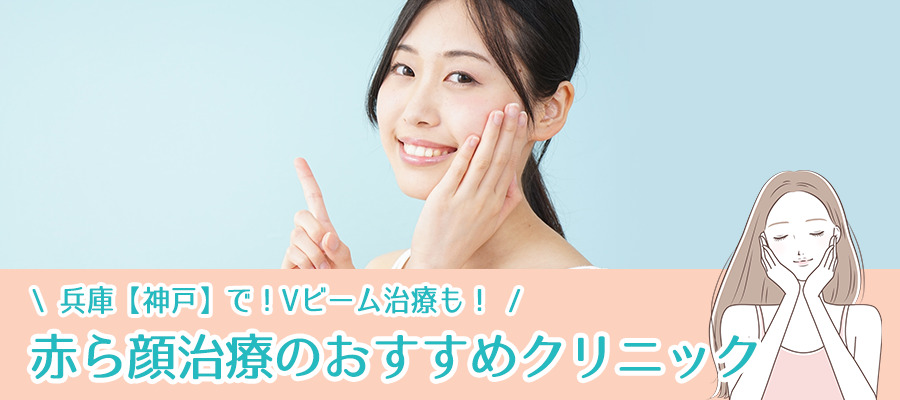安い！兵庫【神戸】で赤ら顔治療ができるおすすめクリニック8選！Vビーム治療